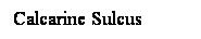 Cuadro de texto: Calcarine Sulcus
